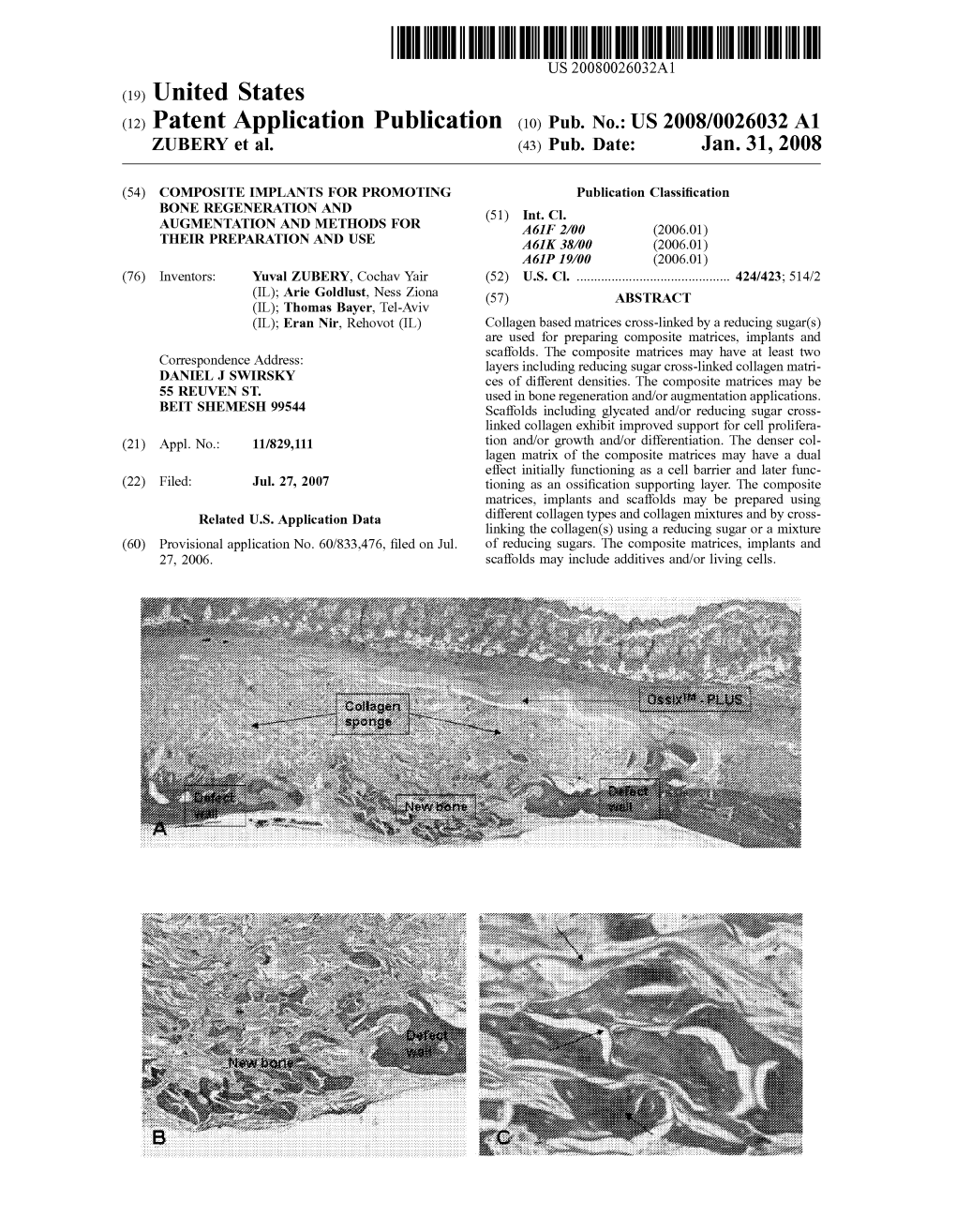 (12) Patent Application Publication (10) Pub. No.: US 2008/0026032 A1 ZUBERY Et Al