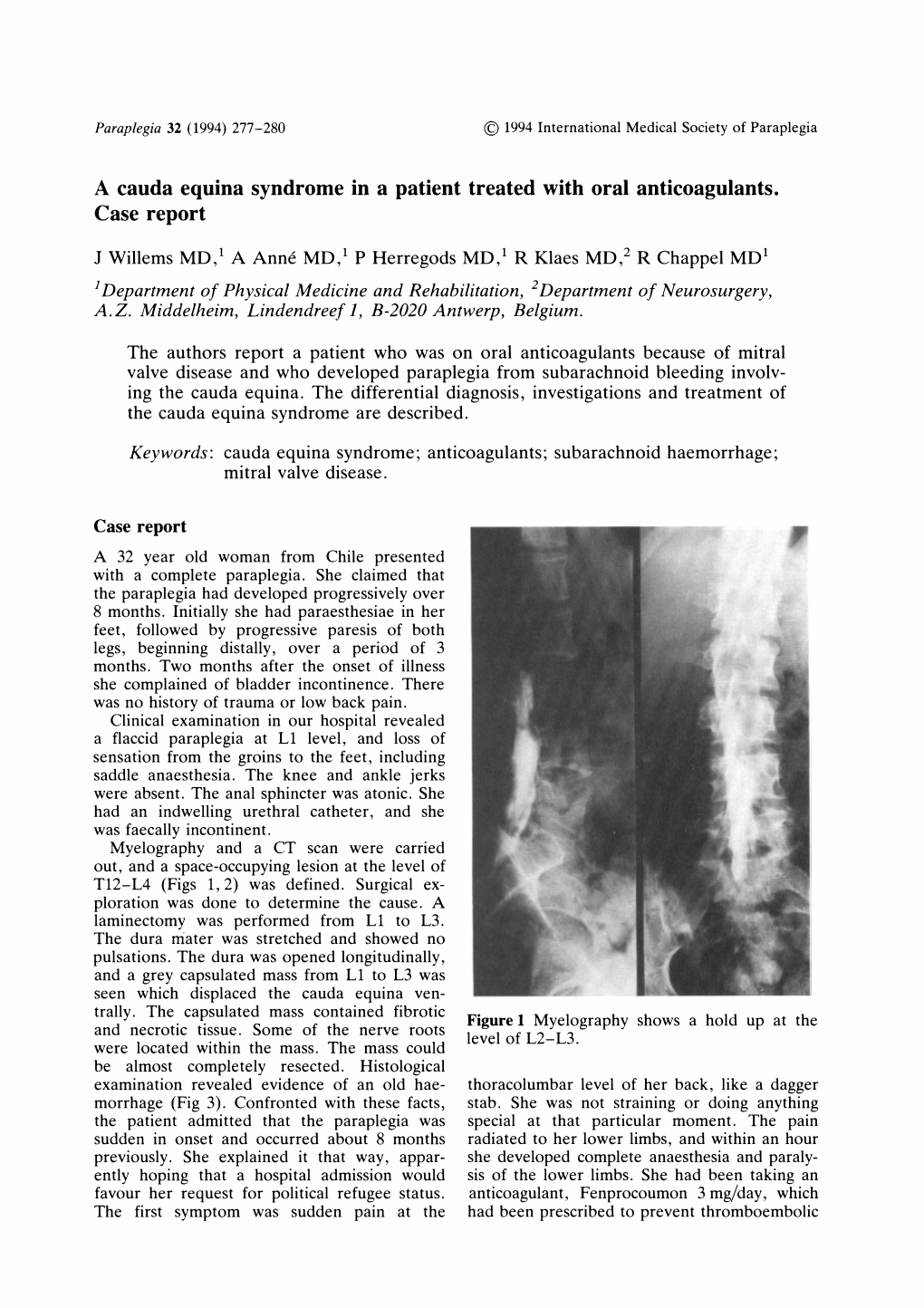 A Cauda Equina Syndrome in a Patient Treated with Oral Anticoagulants