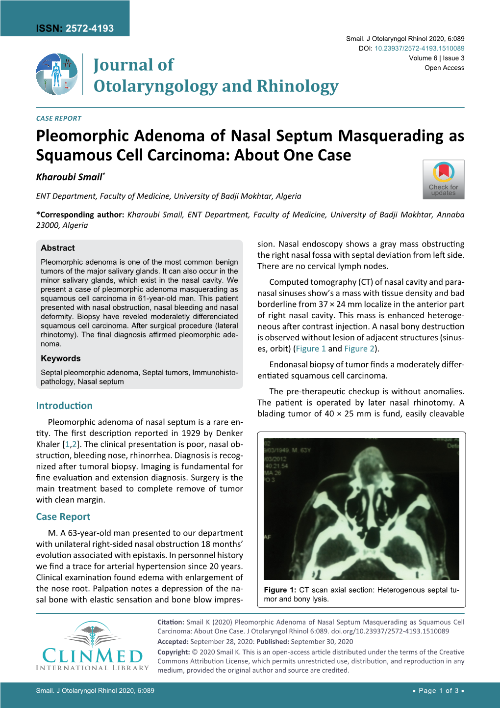 Pleomorphic Adenoma of Nasal Septum Masquerading As Squamous Cell Carcinoma: About One Case