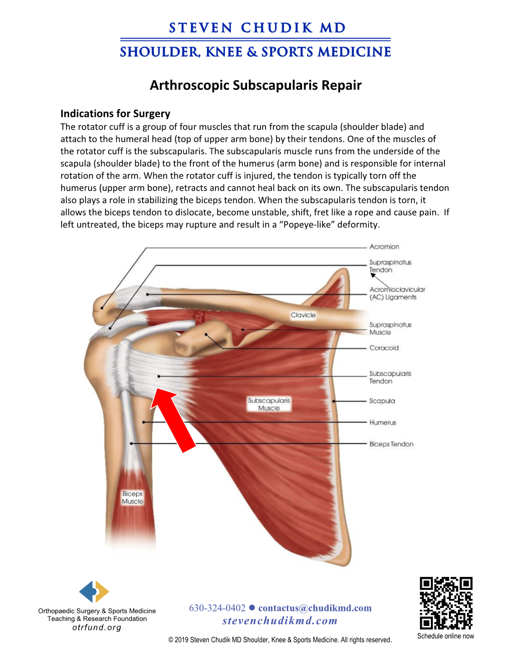 Subscapularis Rotator Cuff Repair