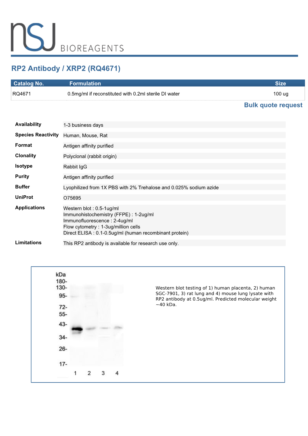 RP2 Antibody / XRP2 (RQ4671)