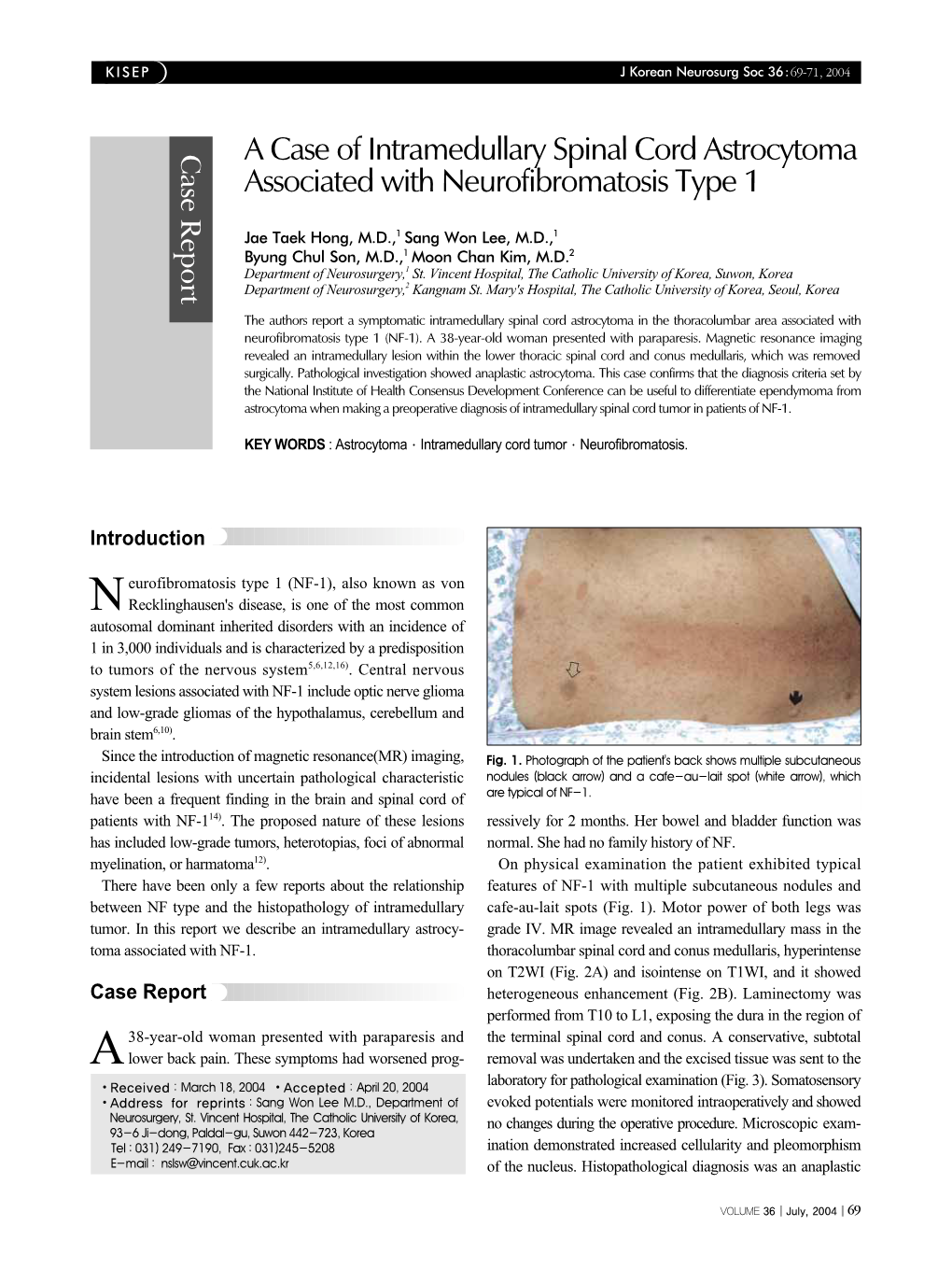 A Case of Intramedullary Spinal Cord Astrocytoma Associated with Neurofibromatosis Type 1