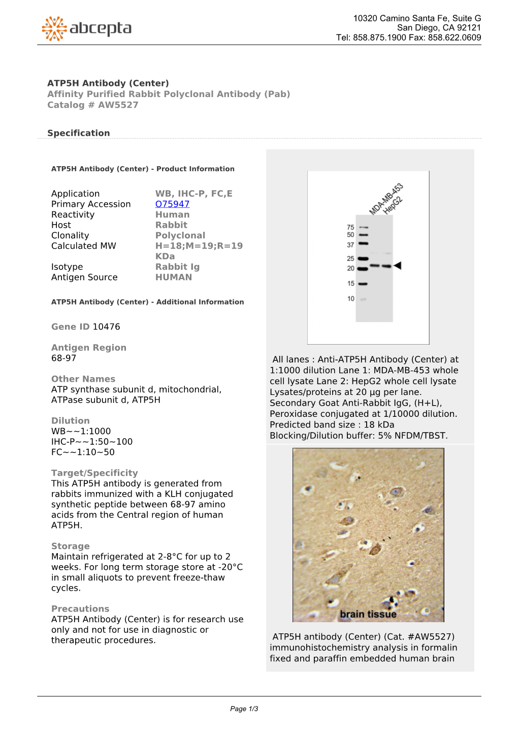 ATP5H Antibody (Center) Affinity Purified Rabbit Polyclonal Antibody (Pab) Catalog # AW5527