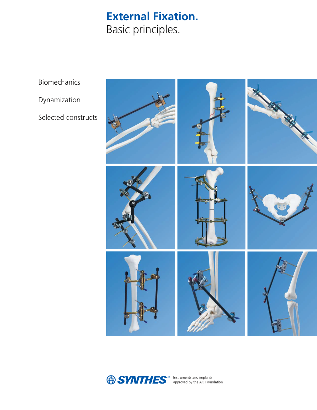 External Fixation