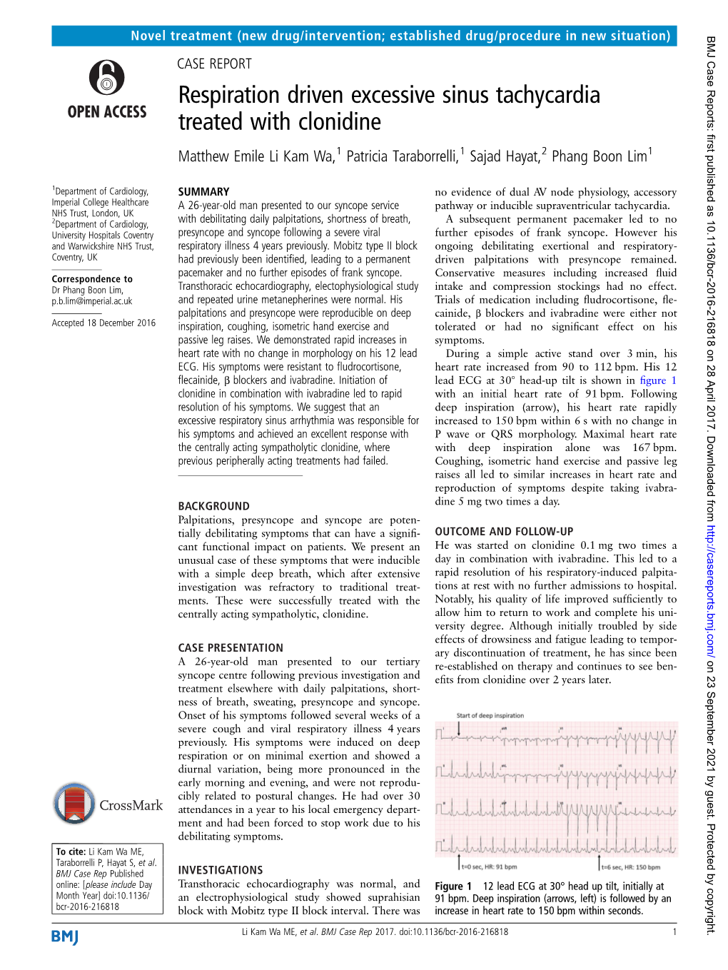 Respiration Driven Excessive Sinus Tachycardia Treated with Clonidine Matthew Emile Li Kam Wa,1 Patricia Taraborrelli,1 Sajad Hayat,2 Phang Boon Lim1