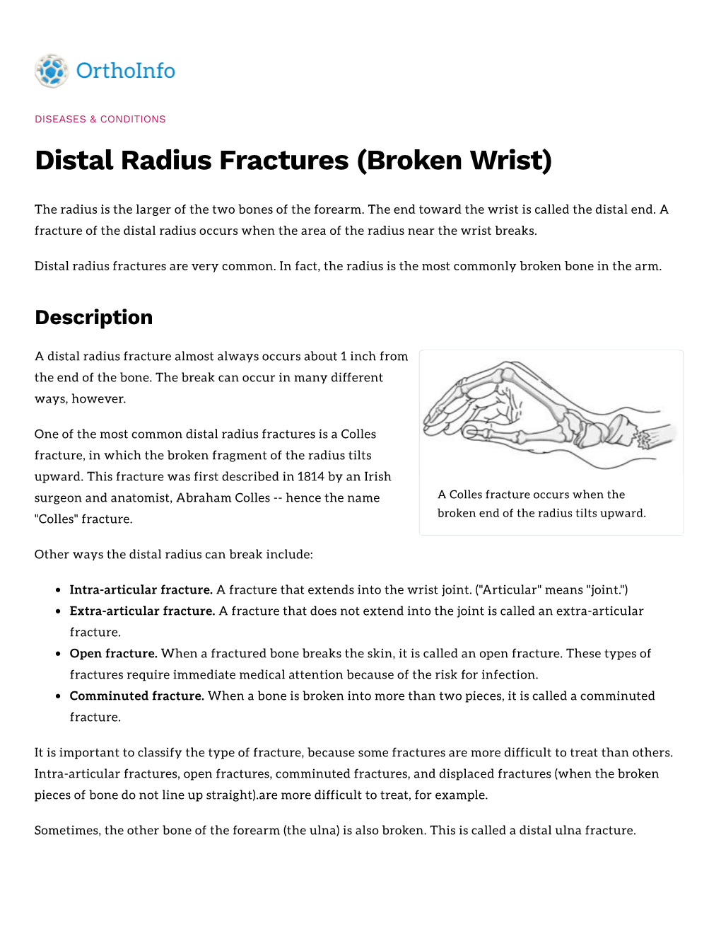 Distal Radius Fractures (Broken Wrist)