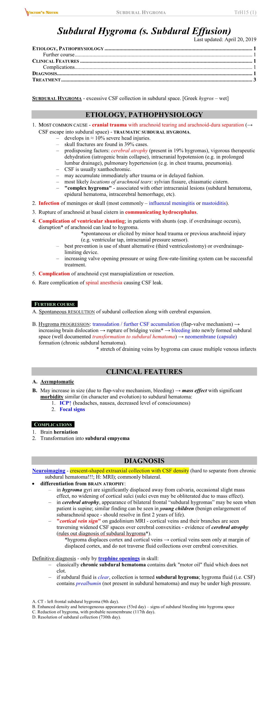 Trh15. Subdural Hygroma.Pdf