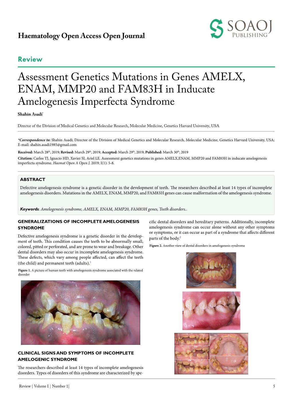 Assessment Genetics Mutations in Genes AMELX, ENAM, MMP20 and FAM83H in Inducate Amelogenesis Imperfecta Syndrome Shahin Asadi*