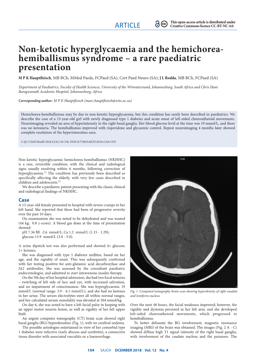 Non-Ketotic Hyperglycaemia and the Hemichorea- Hemiballismus