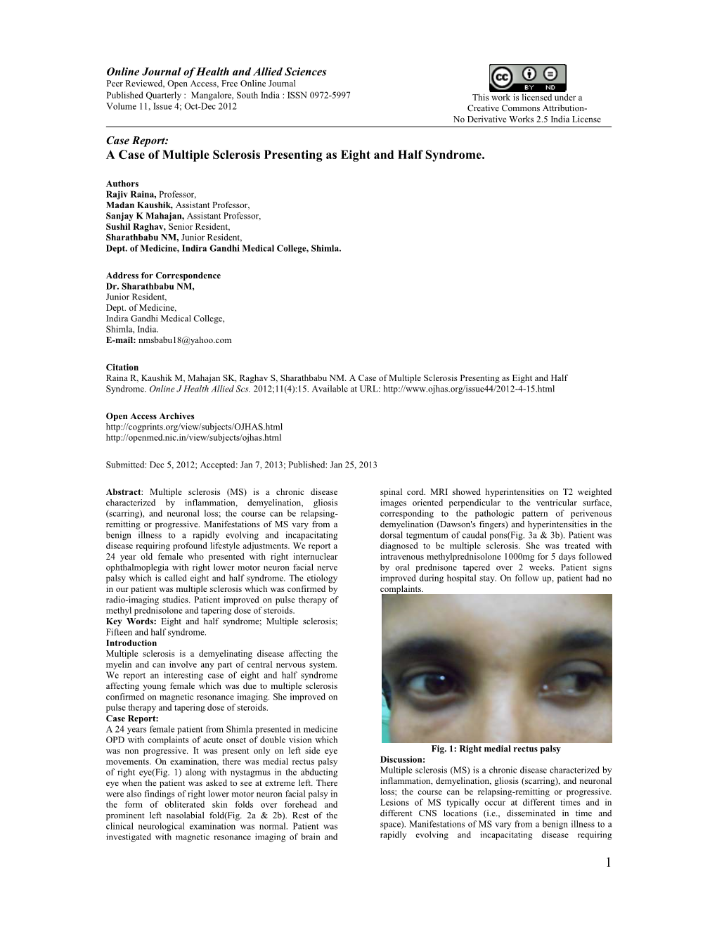 A Case of Multiple Sclerosis Presenting As Eight and Half Syndrome