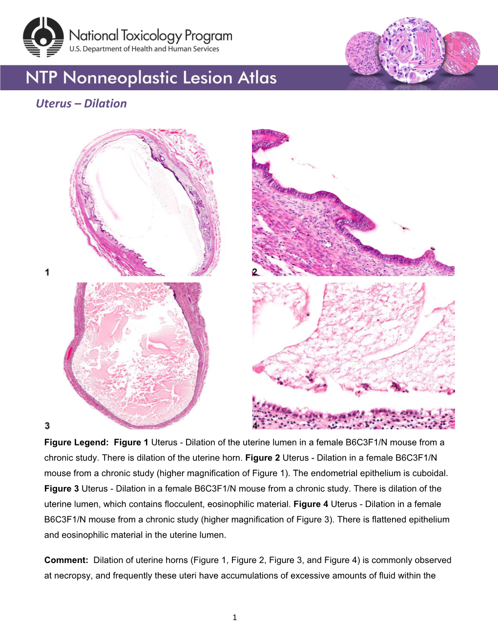 Uterus – Dilation