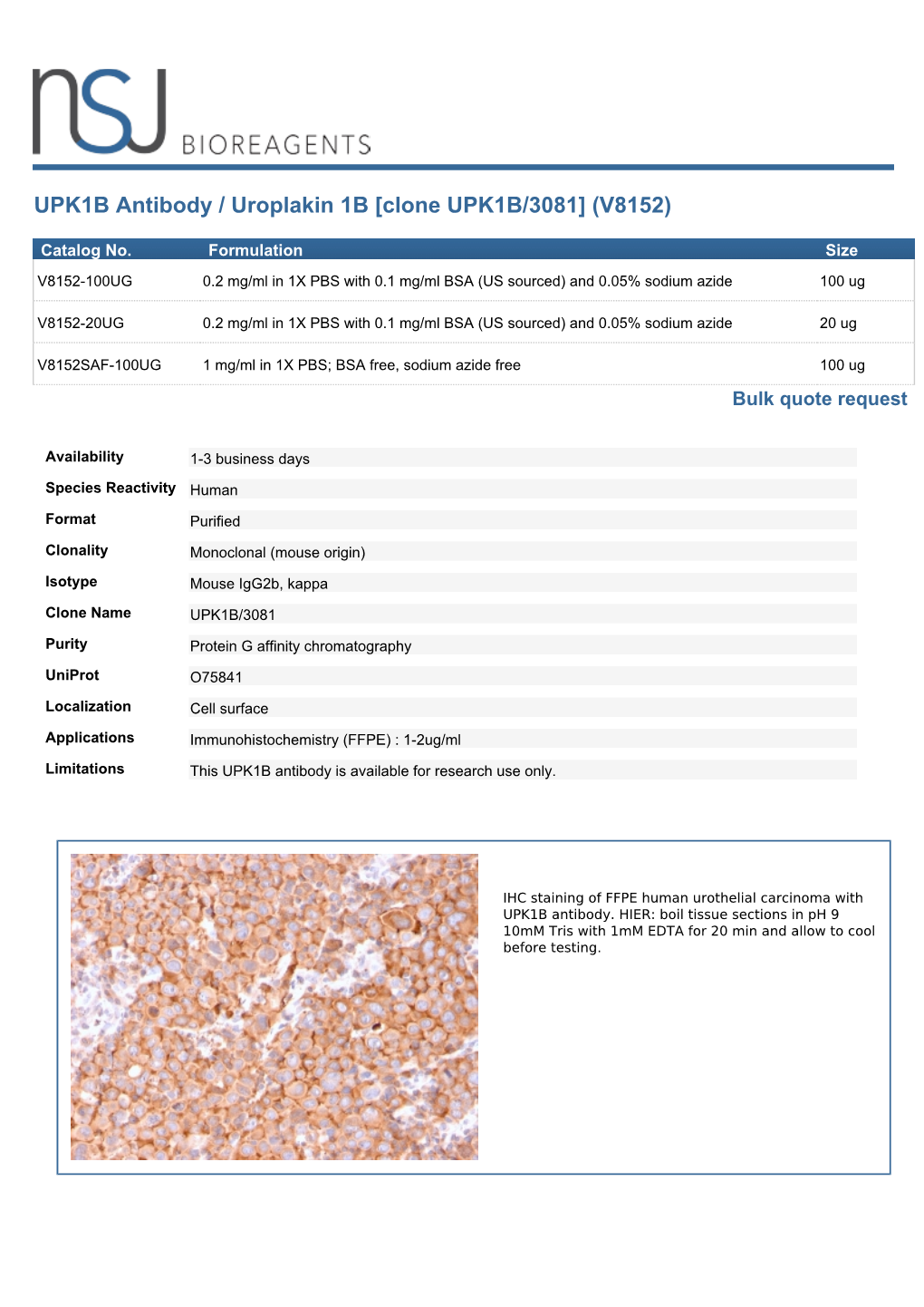 UPK1B Antibody / Uroplakin 1B [Clone UPK1B/3081] (V8152)