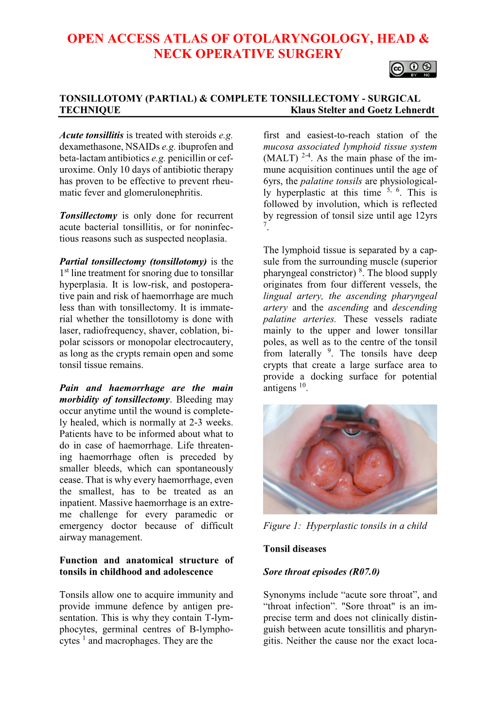 Tonsillotomy (Partial) and Complete Tonsillectomy