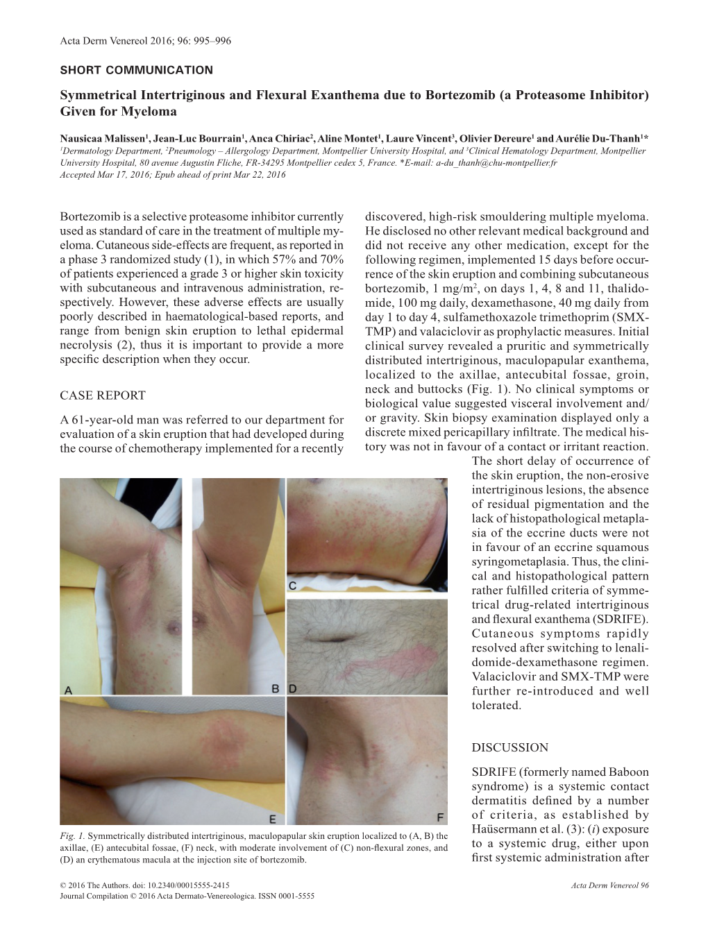 Symmetrical Intertriginous and Flexural Exanthema Due to Bortezomib (A Proteasome Inhibitor) Given for Myeloma