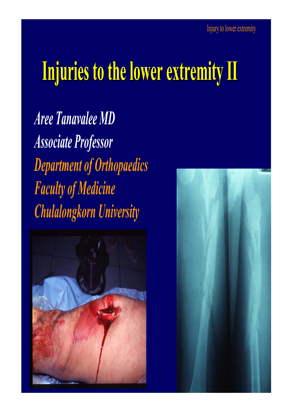 Injuries to the Lower Extremity II