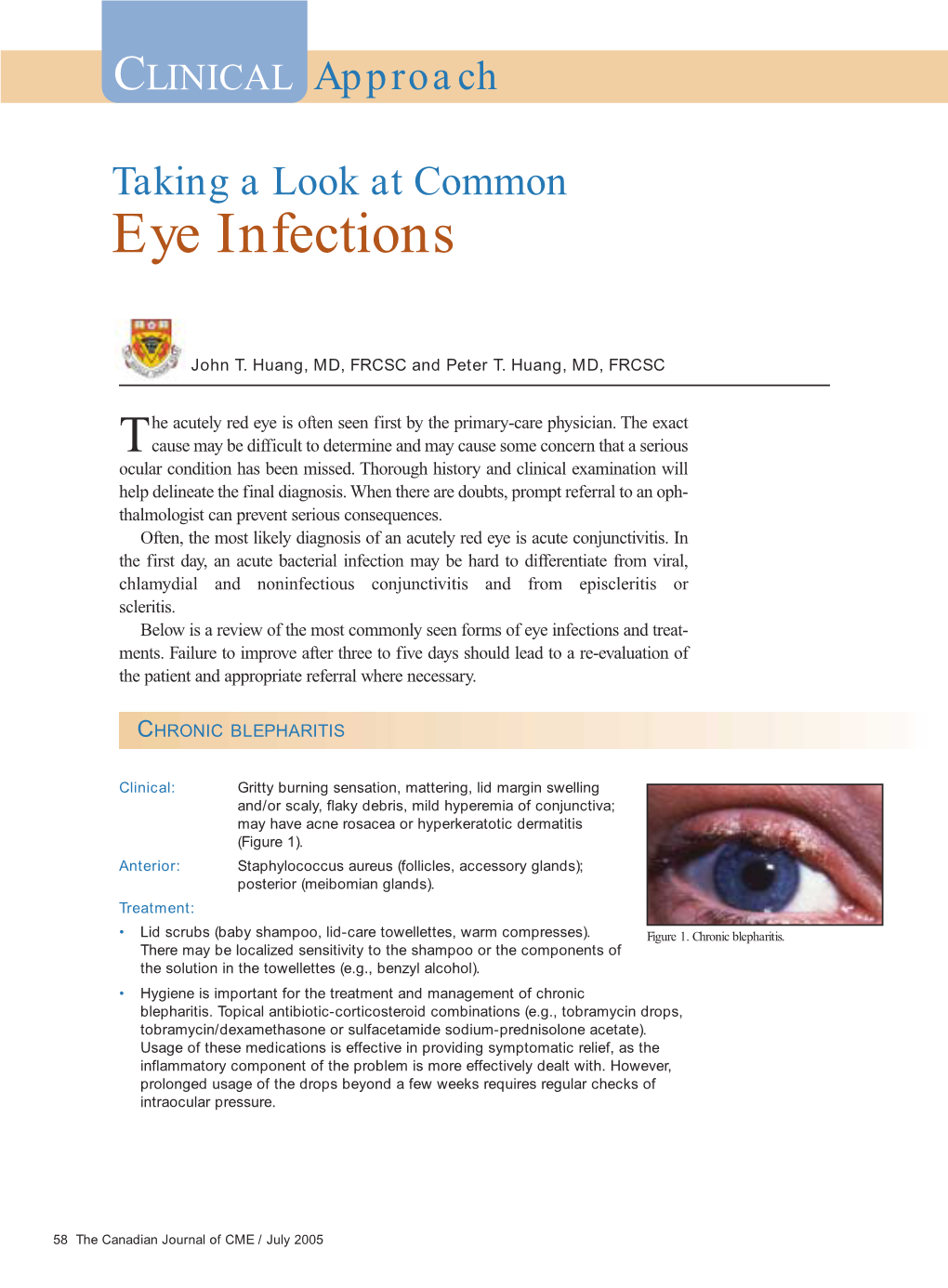 Eye Infections