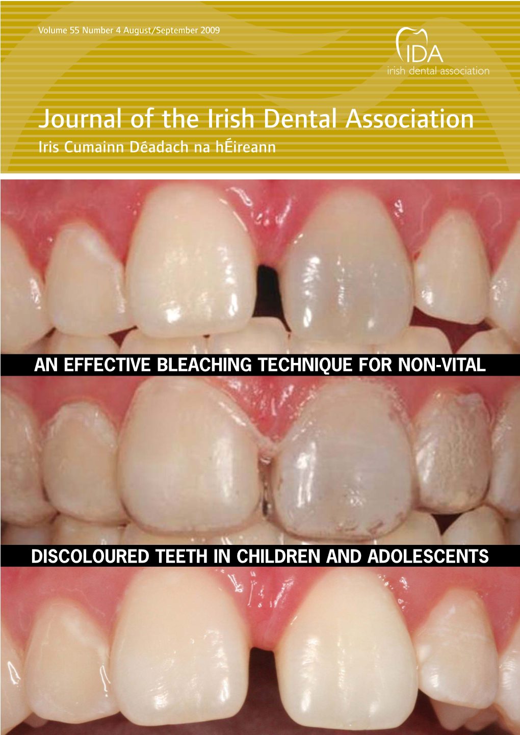 Journal of the Irish Dental Association Iris Cumainn Déadach Na Héireann