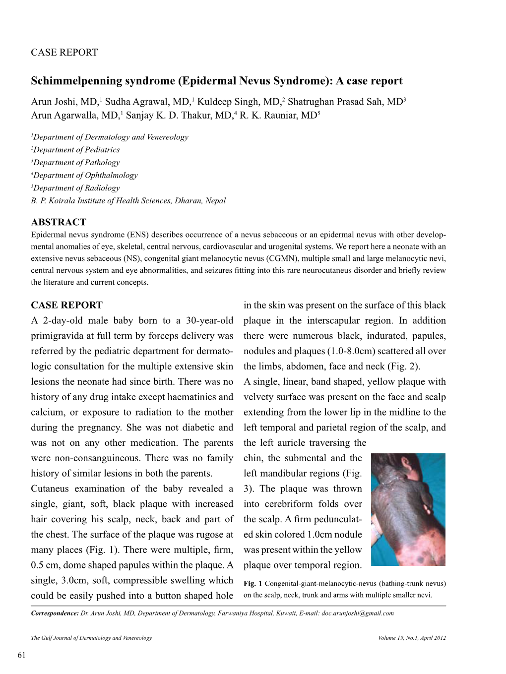 Epidermal Nevus Syndrome): a Case Report Arun Joshi, MD,1 Sudha Agrawal, MD,1 Kuldeep Singh, MD,2 Shatrughan Prasad Sah, MD3 Arun Agarwalla, MD,1 Sanjay K