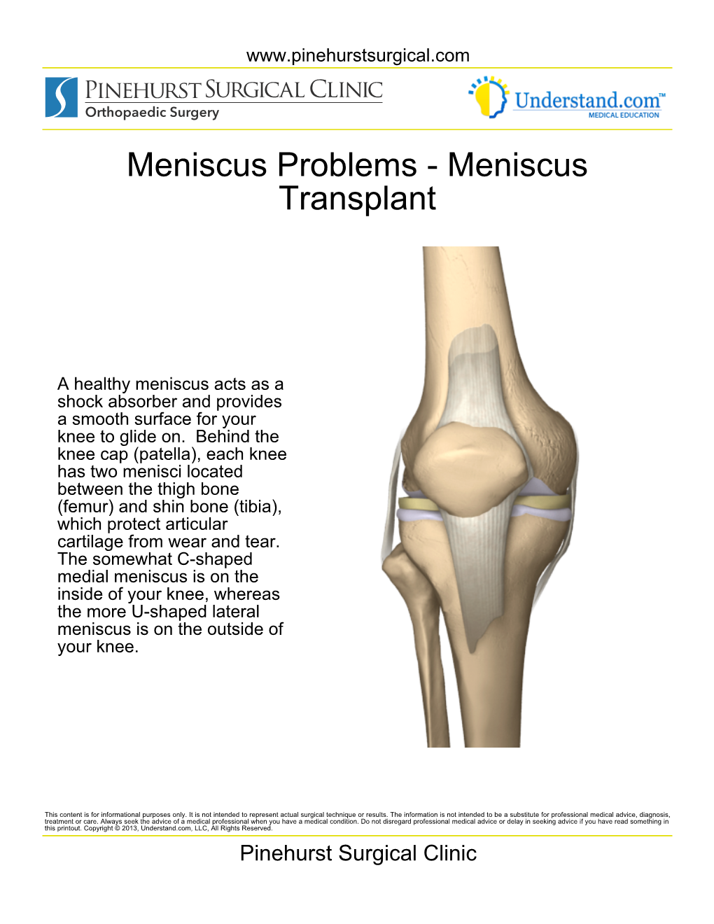 Meniscus Transplant