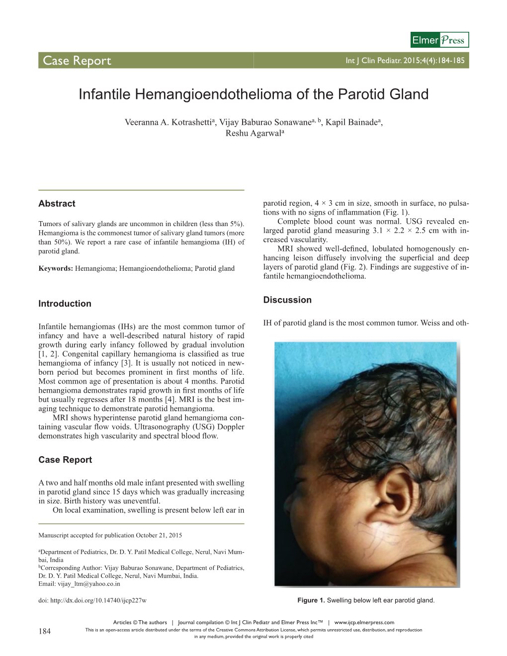 Infantile Hemangioendothelioma of the Parotid Gland