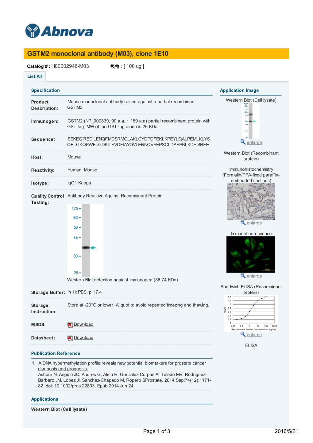GSTM2 Monoclonal Antibody (M03), Clone 1E10