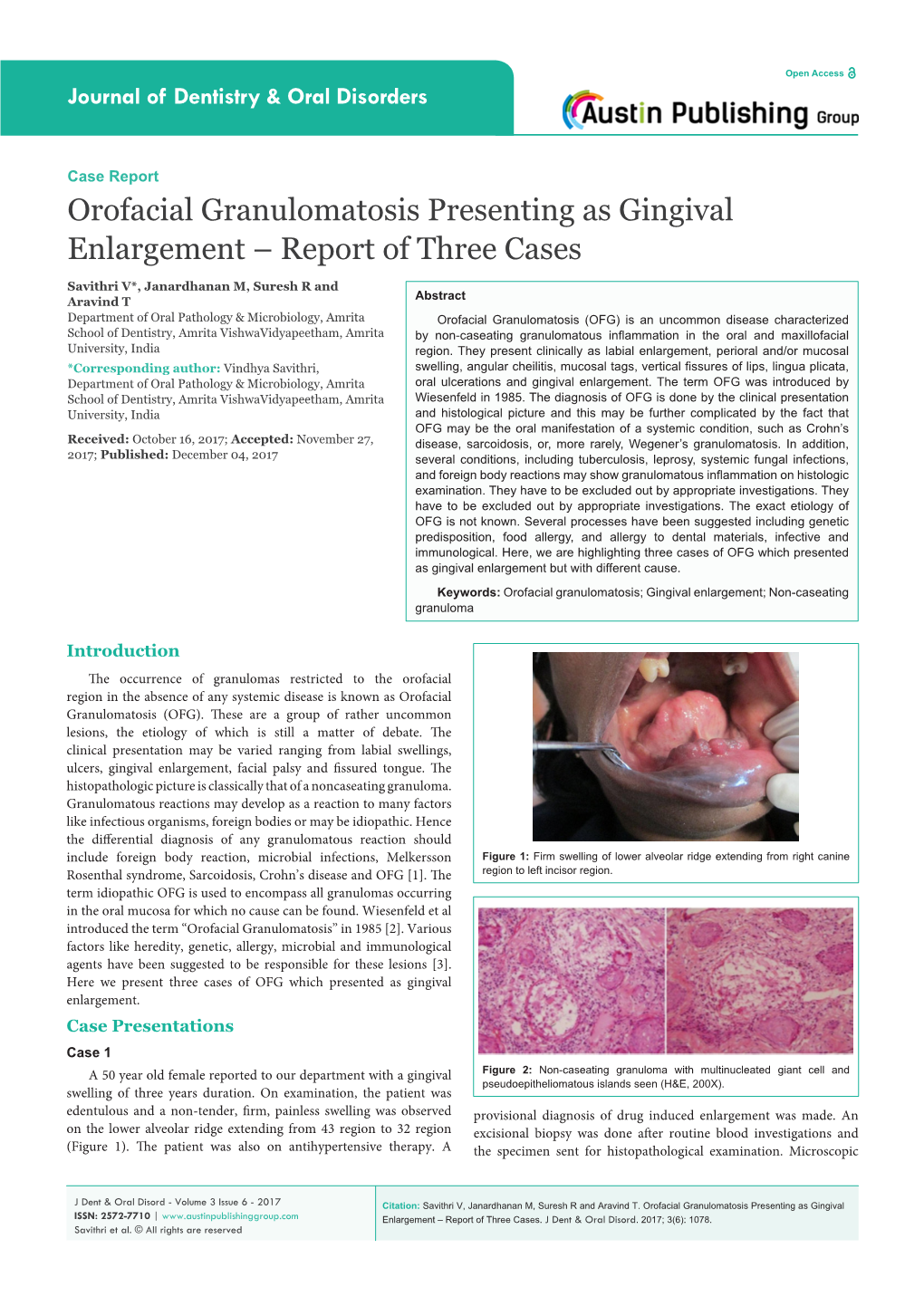 Orofacial Granulomatosis Presenting As Gingival Enlargement – Report of Three Cases