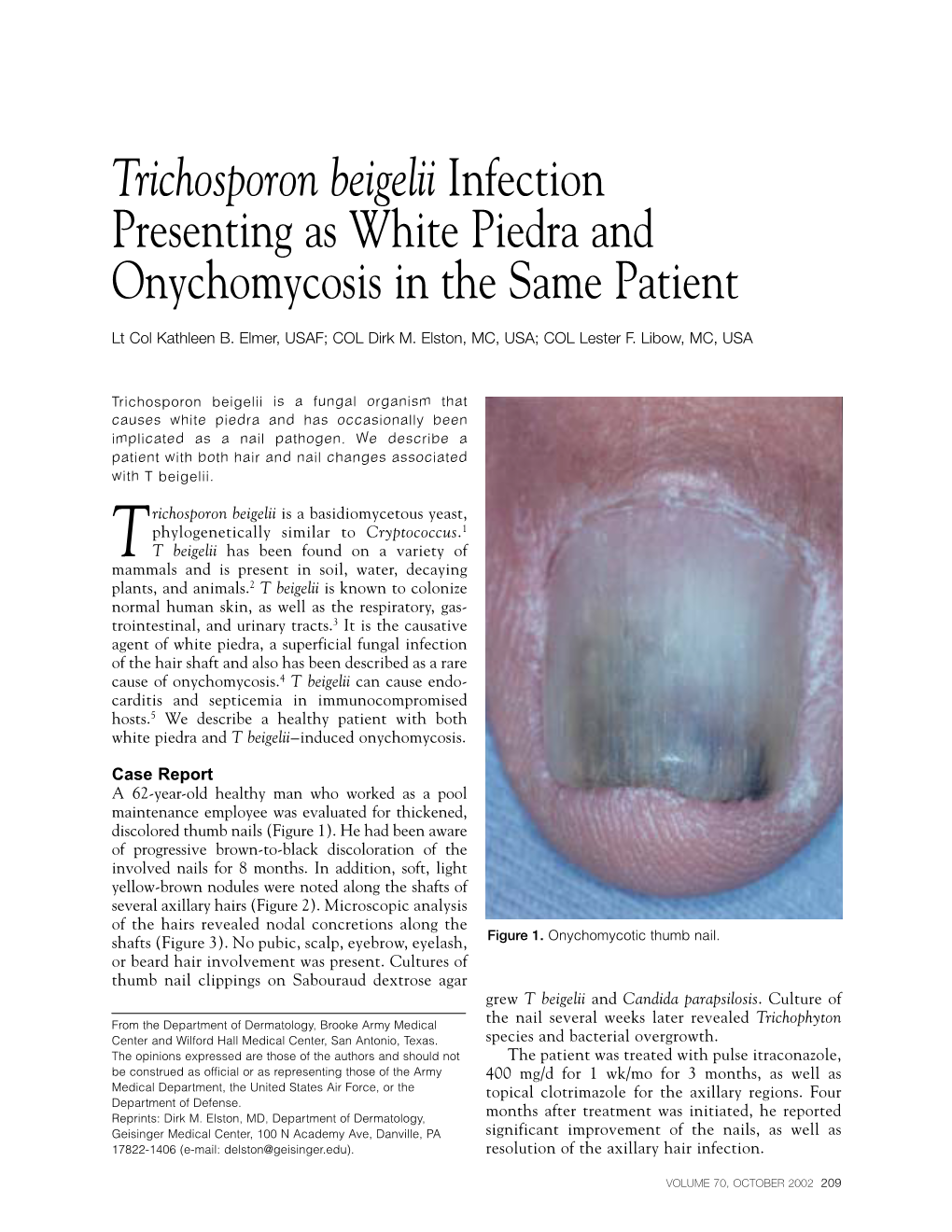 Trichosporon Beigelii Infection Presenting As White Piedra and Onychomycosis in the Same Patient