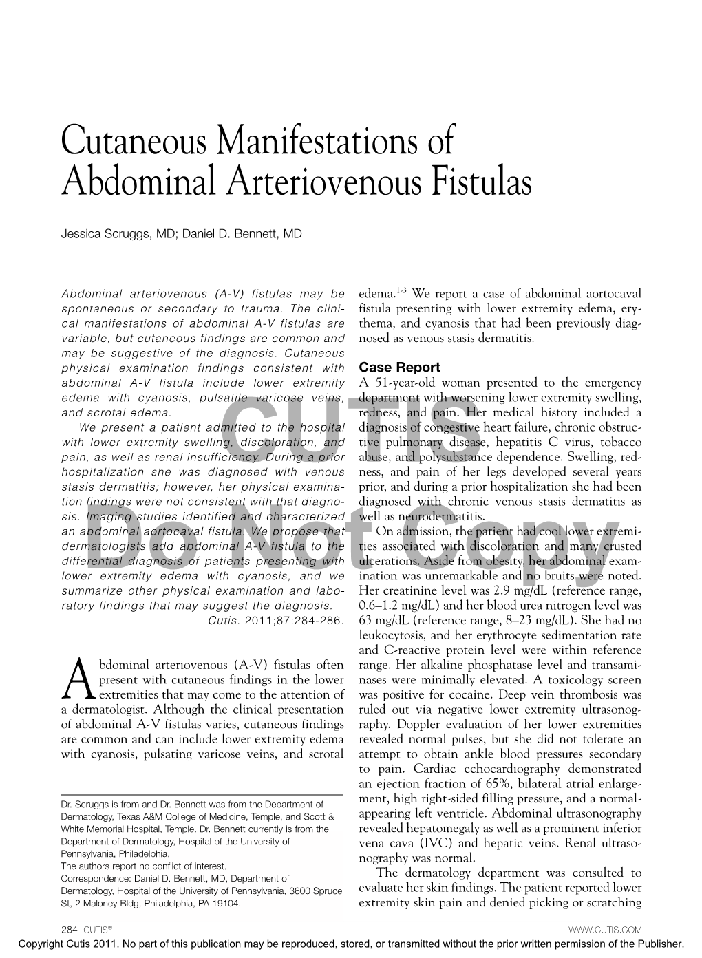 Cutaneous Manifestations of Abdominal Arteriovenous Fistulas