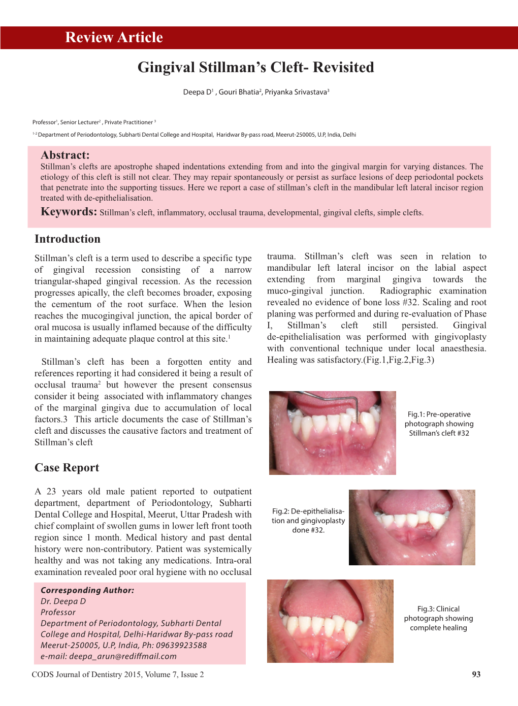 Gingival Stillman's Cleft- Revisited Review Article