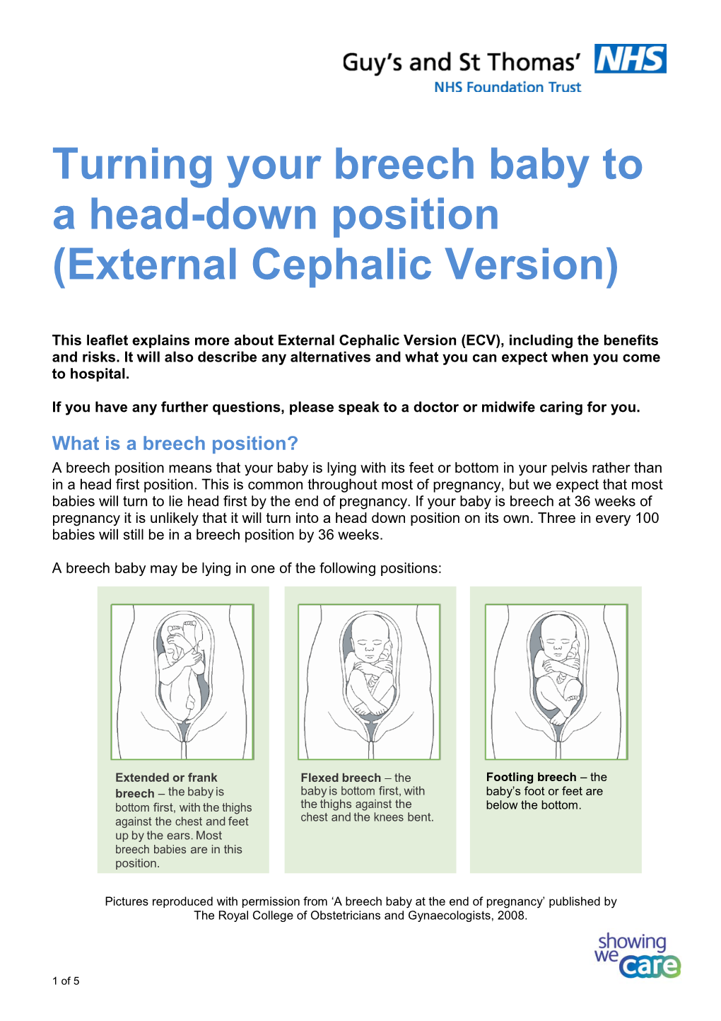 Turning Your Breech Baby to a Head-Down Position (External Cephalic Version)