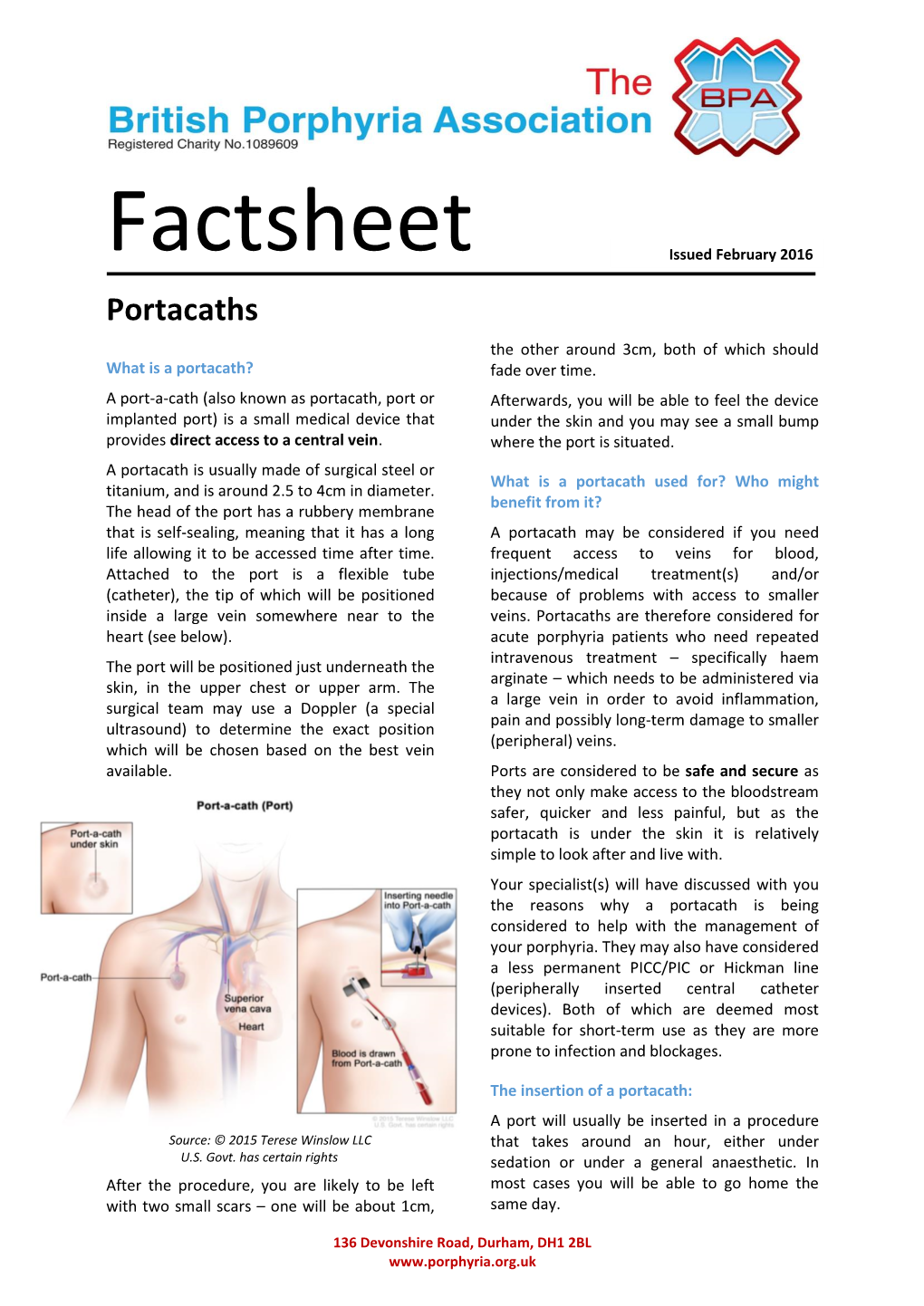 What Is a Portacath? Fade Over Time