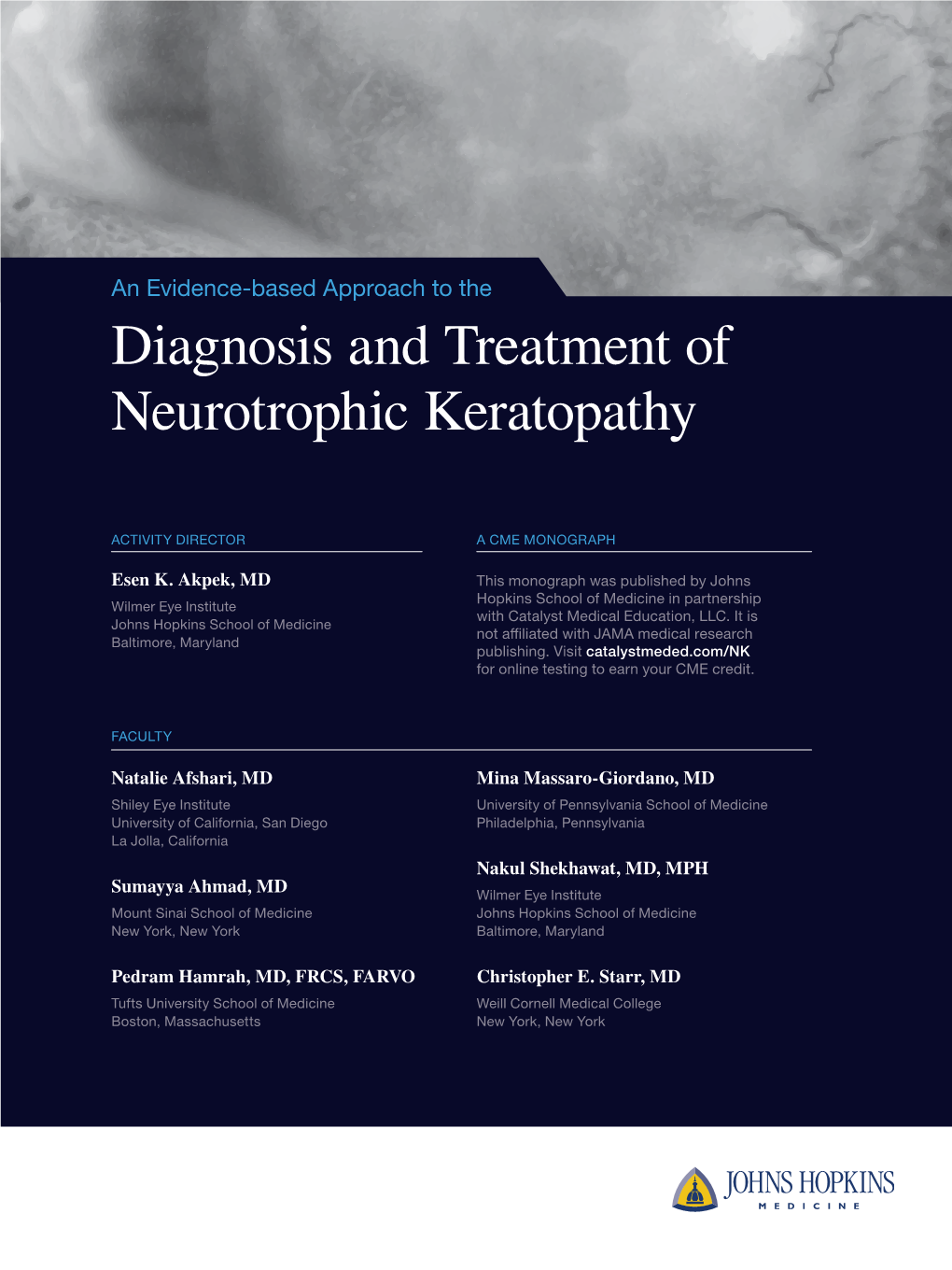 Diagnosis and Treatment of Neurotrophic Keratopathy