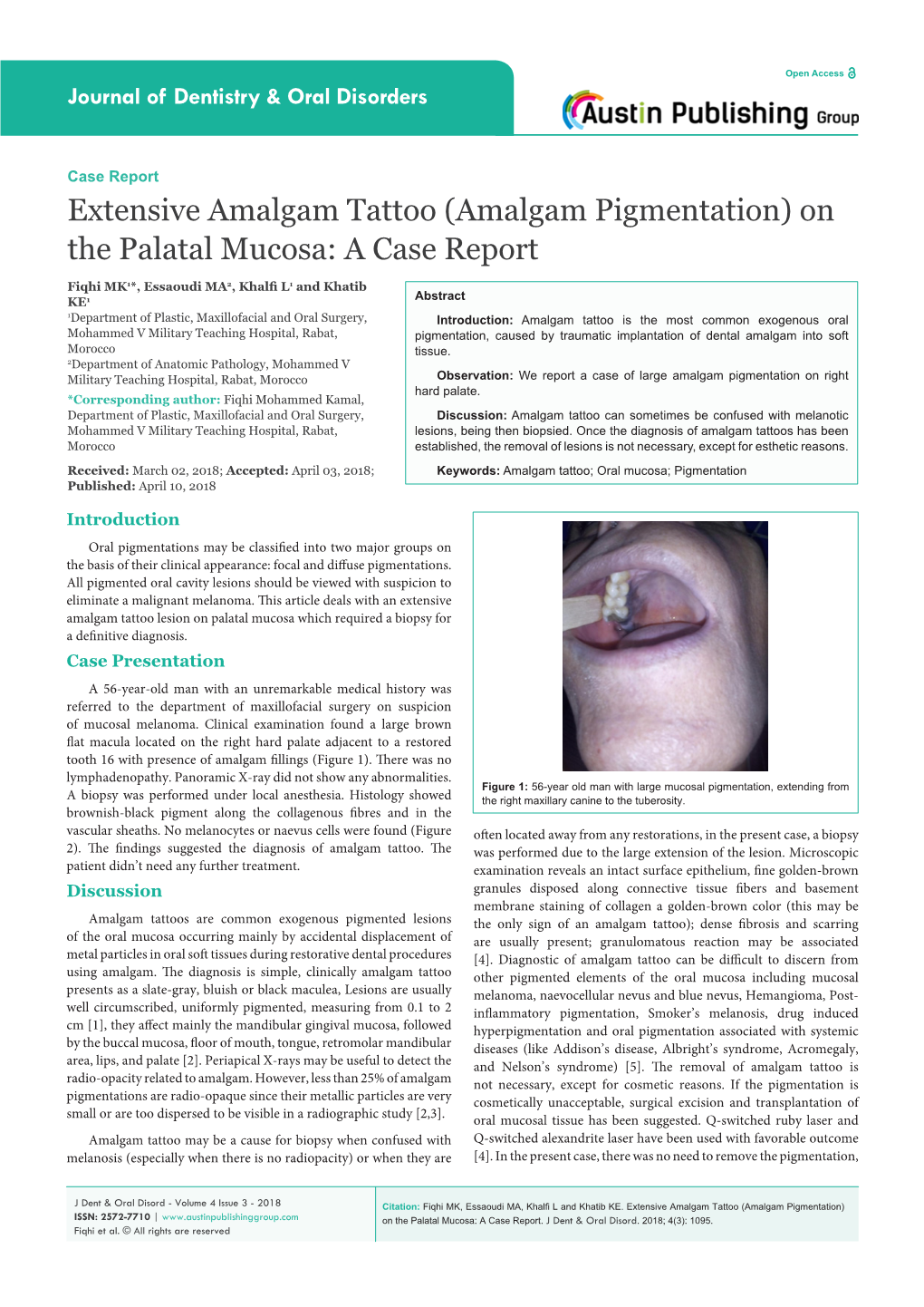 Amalgam Pigmentation) on the Palatal Mucosa: a Case Report