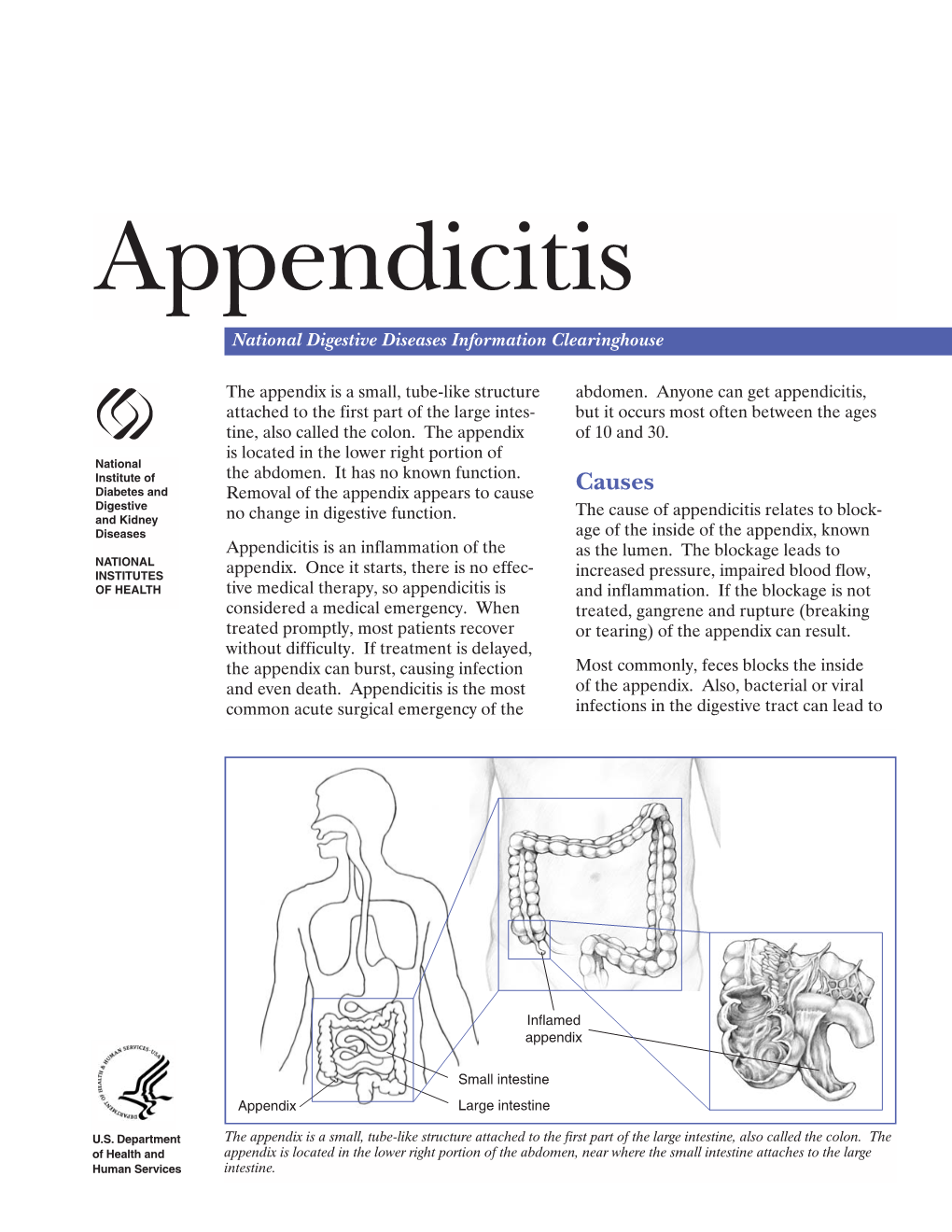 Appendicitis