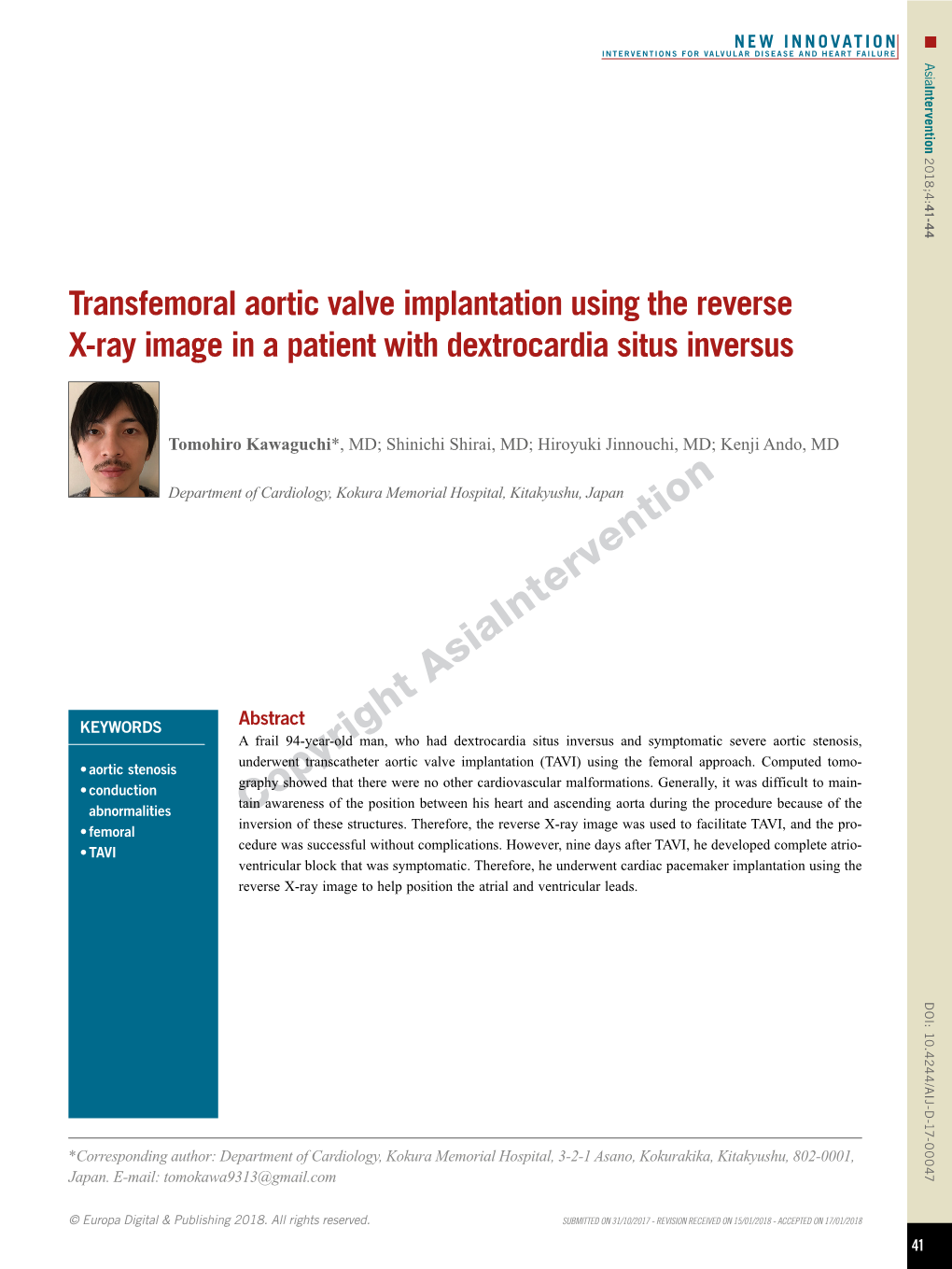 Transfemoral Aortic Valve Implantation Using the Reverse X-Ray Image in a Patient with Dextrocardia Situs Inversus