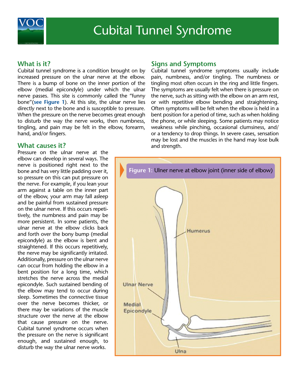 Cubital Tunnel Syndrome