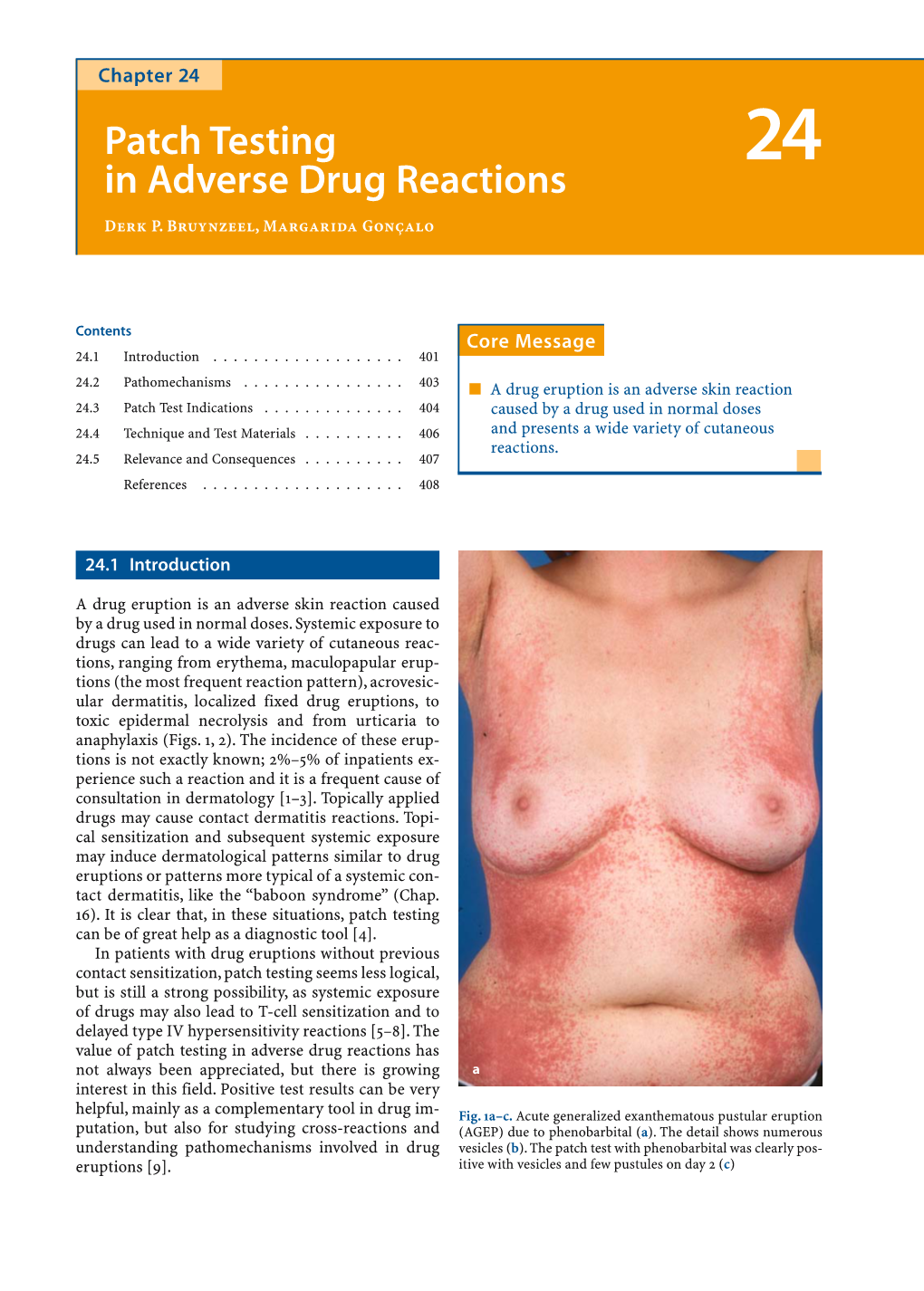 Patch Testing in Adverse Drug Reactions Has Not Always Been Appreciated, but There Is Growing a Interest in This Field