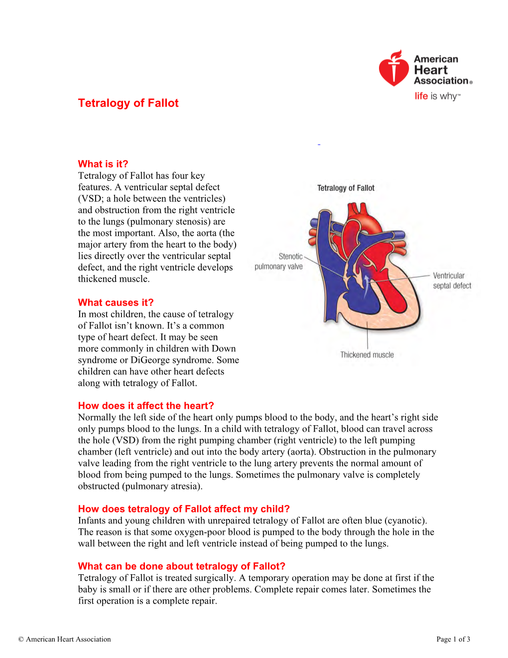 Tetralogy of Fallot