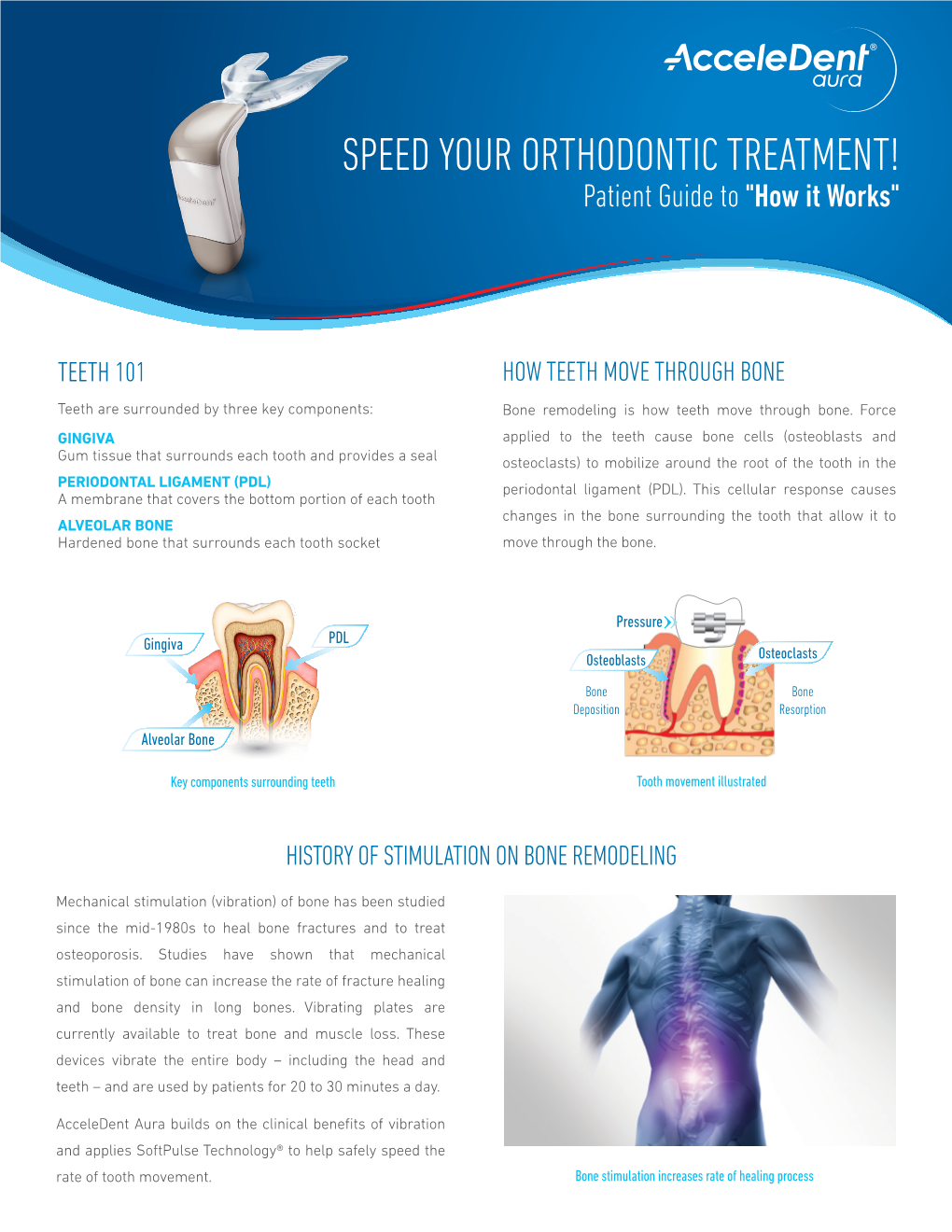 SPEED YOUR ORTHODONTIC TREATMENT! Patient Guide to "How It Works"