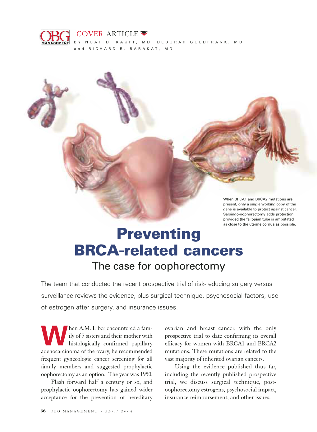 Preventing BRCA-Related Cancers the Case for Oophorectomy