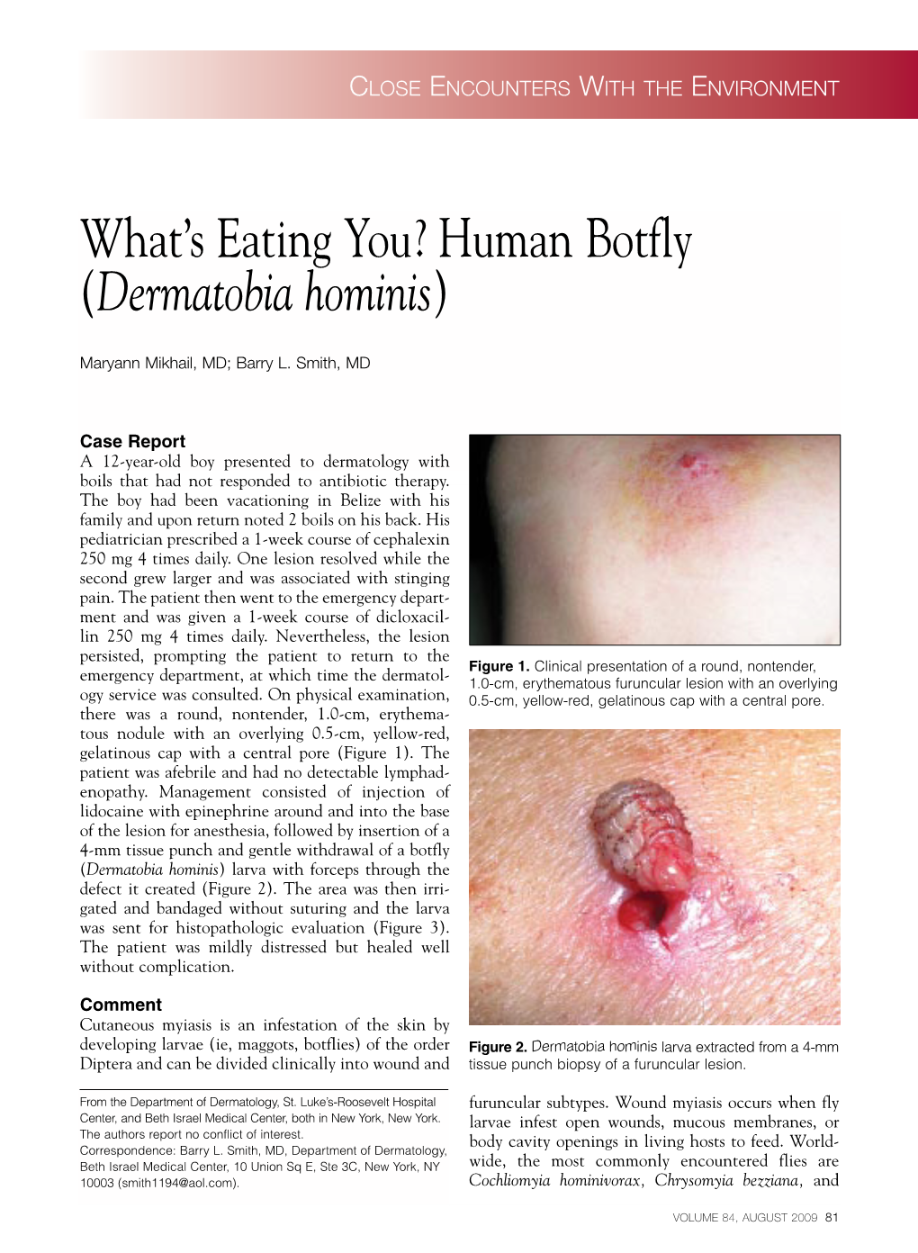 Human Botfly (Dermatobia Hominis)