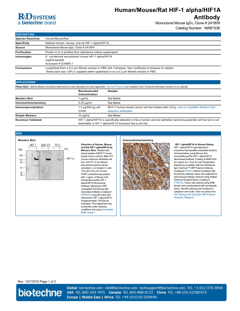 Human/Mouse/Rat HIF-1 Alpha/HIF1A Antibody