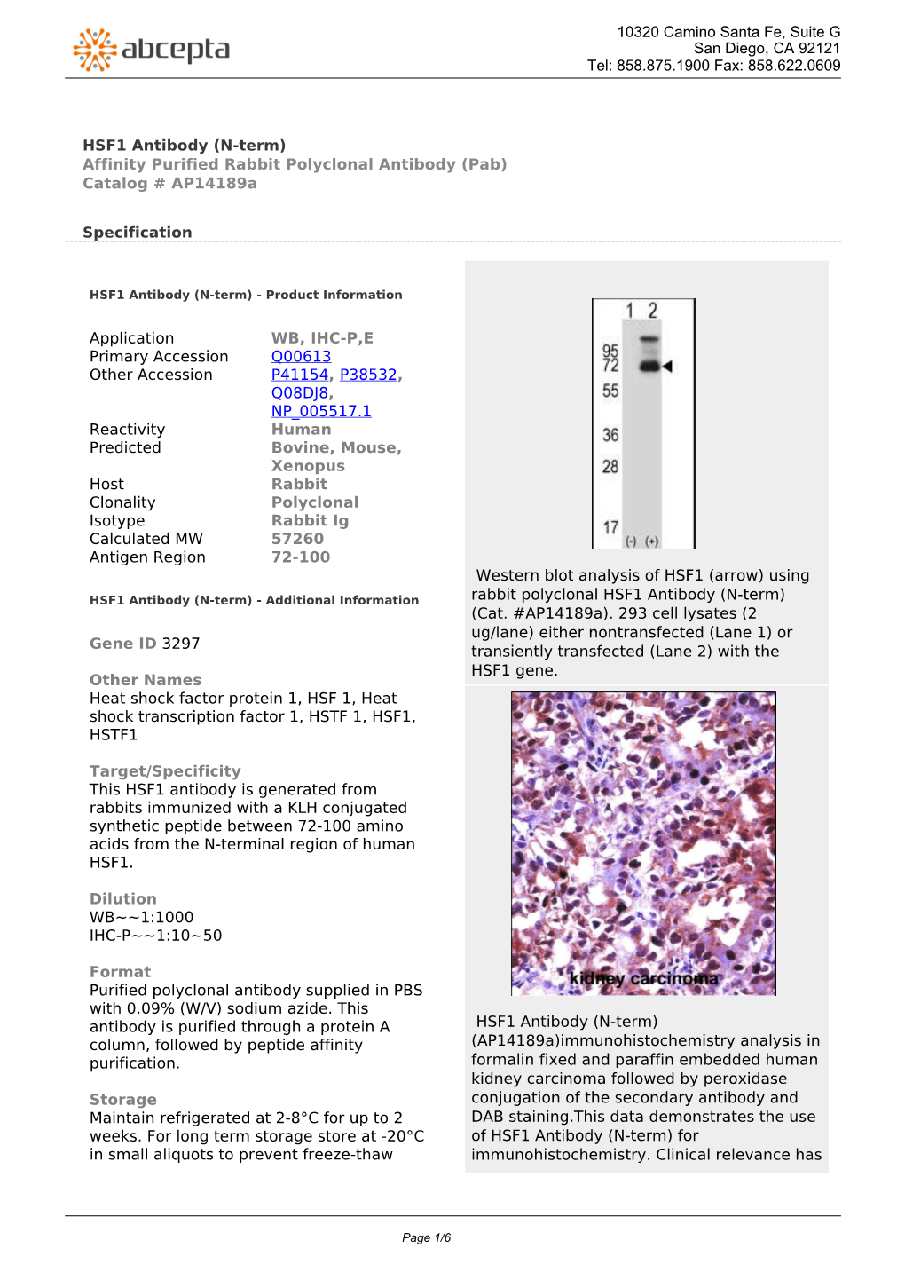 HSF1 Antibody (N-Term) Affinity Purified Rabbit Polyclonal Antibody (Pab) Catalog # Ap14189a