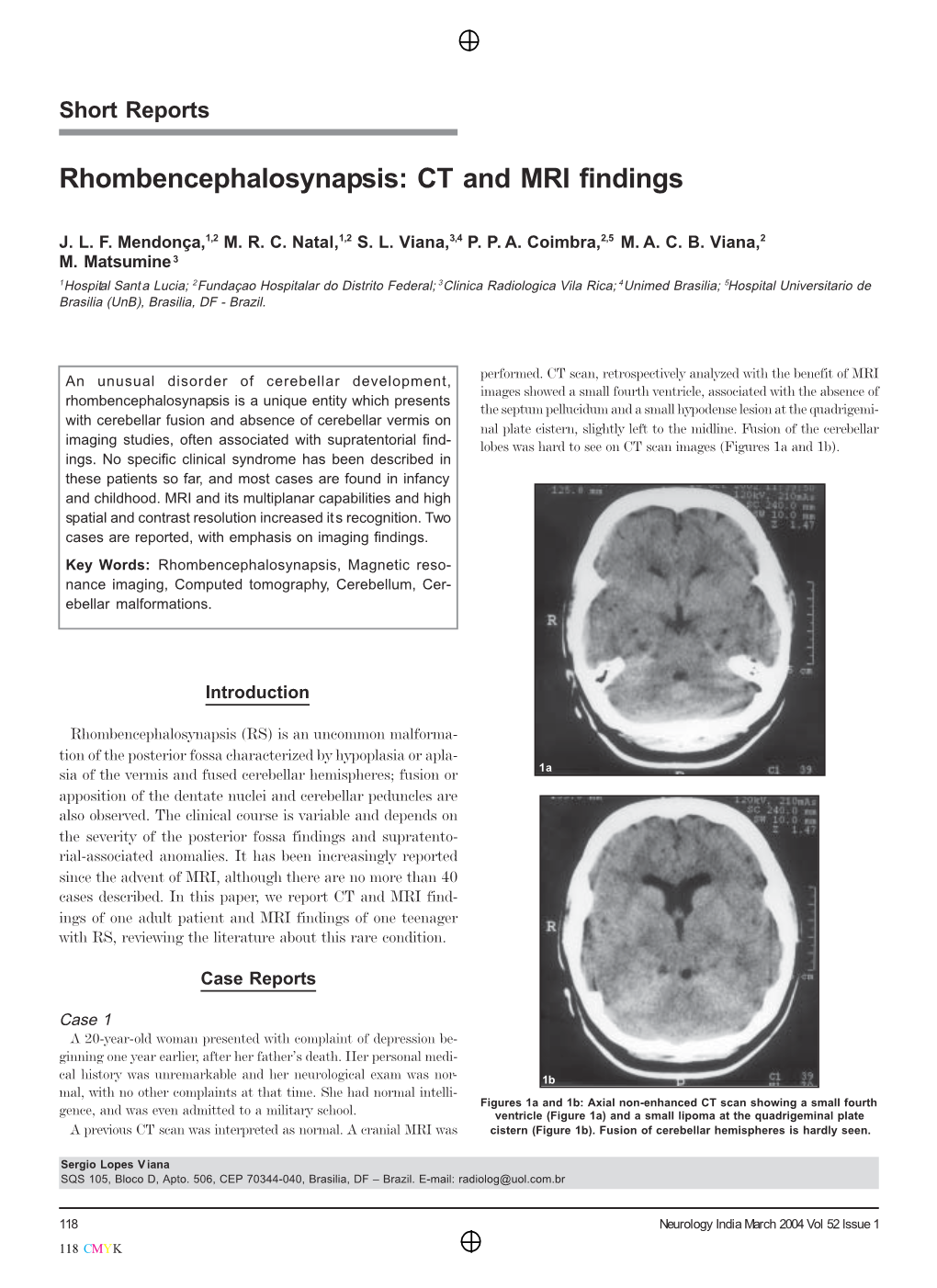 Rhombencephalosynapsis: CT and MRI Findings