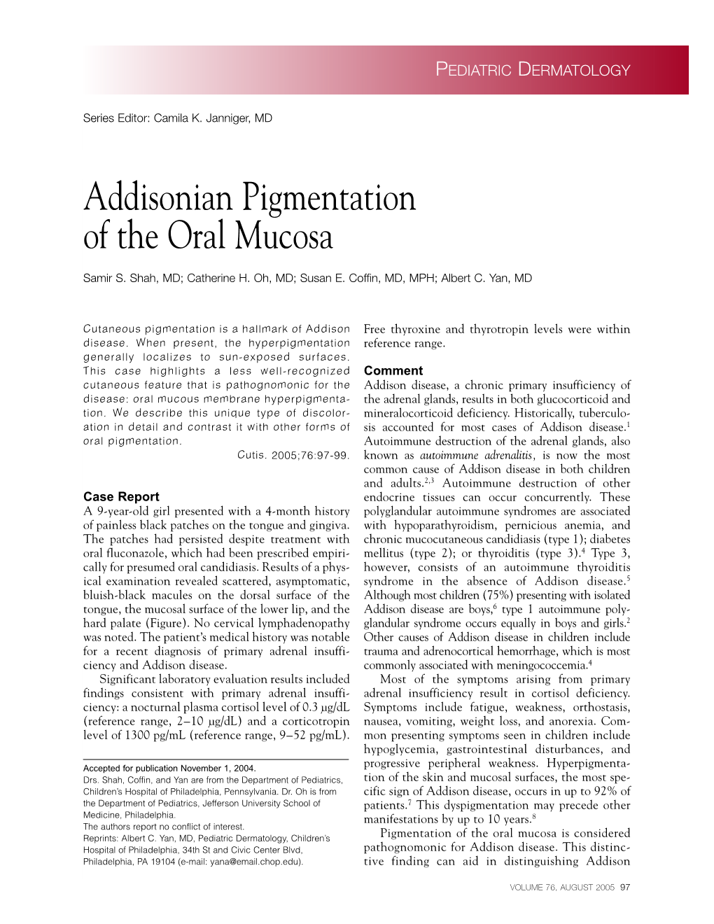 Addisonian Pigmentation of the Oral Mucosa