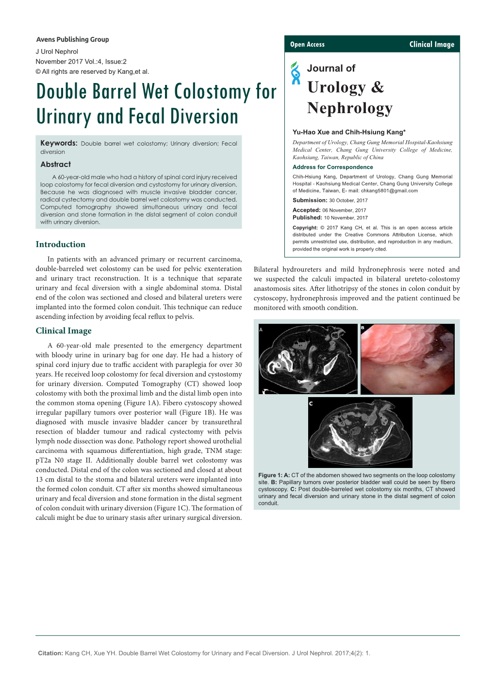 Double Barrel Wet Colostomy for Urinary and Fecal Diversion