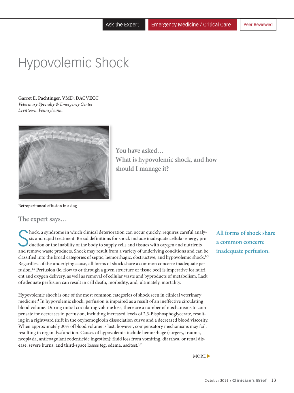 Hypovolemic Shock