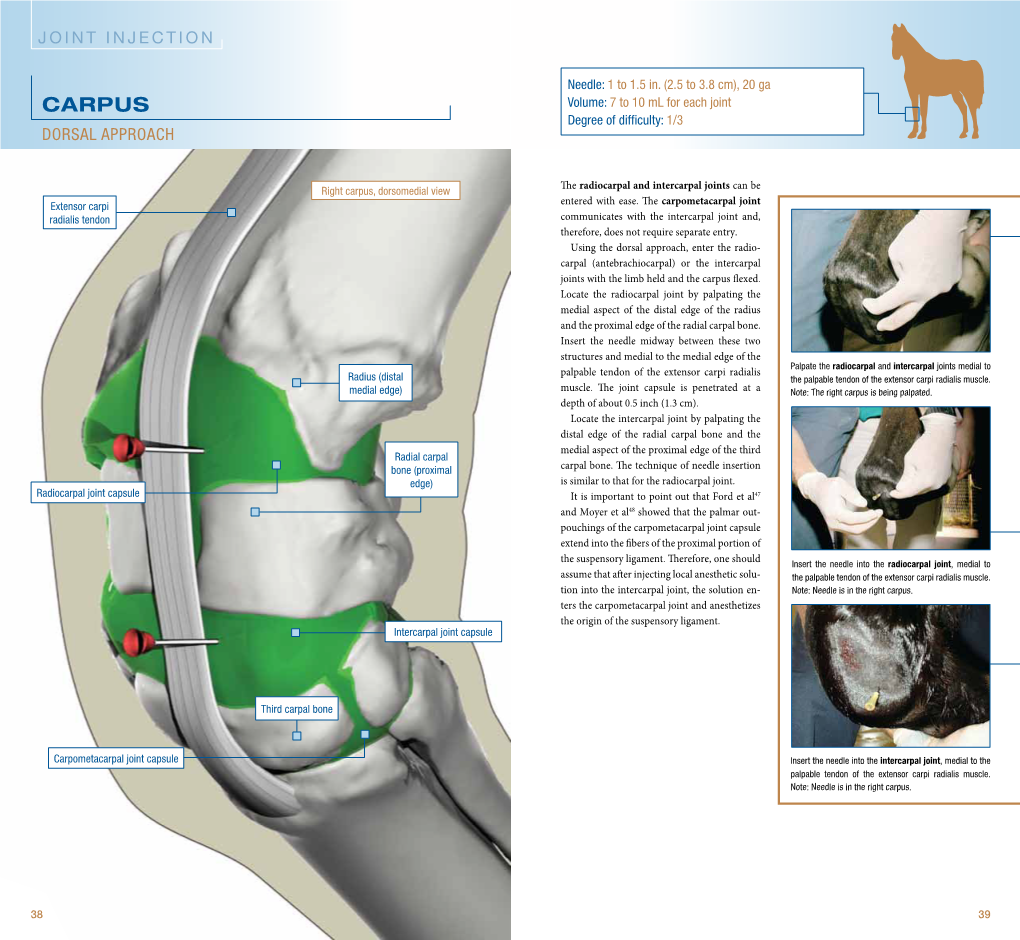 Carpus Volume: 7 to 10 Ml for Each Joint Degree of Difficulty: 1/3 Dorsal Approach