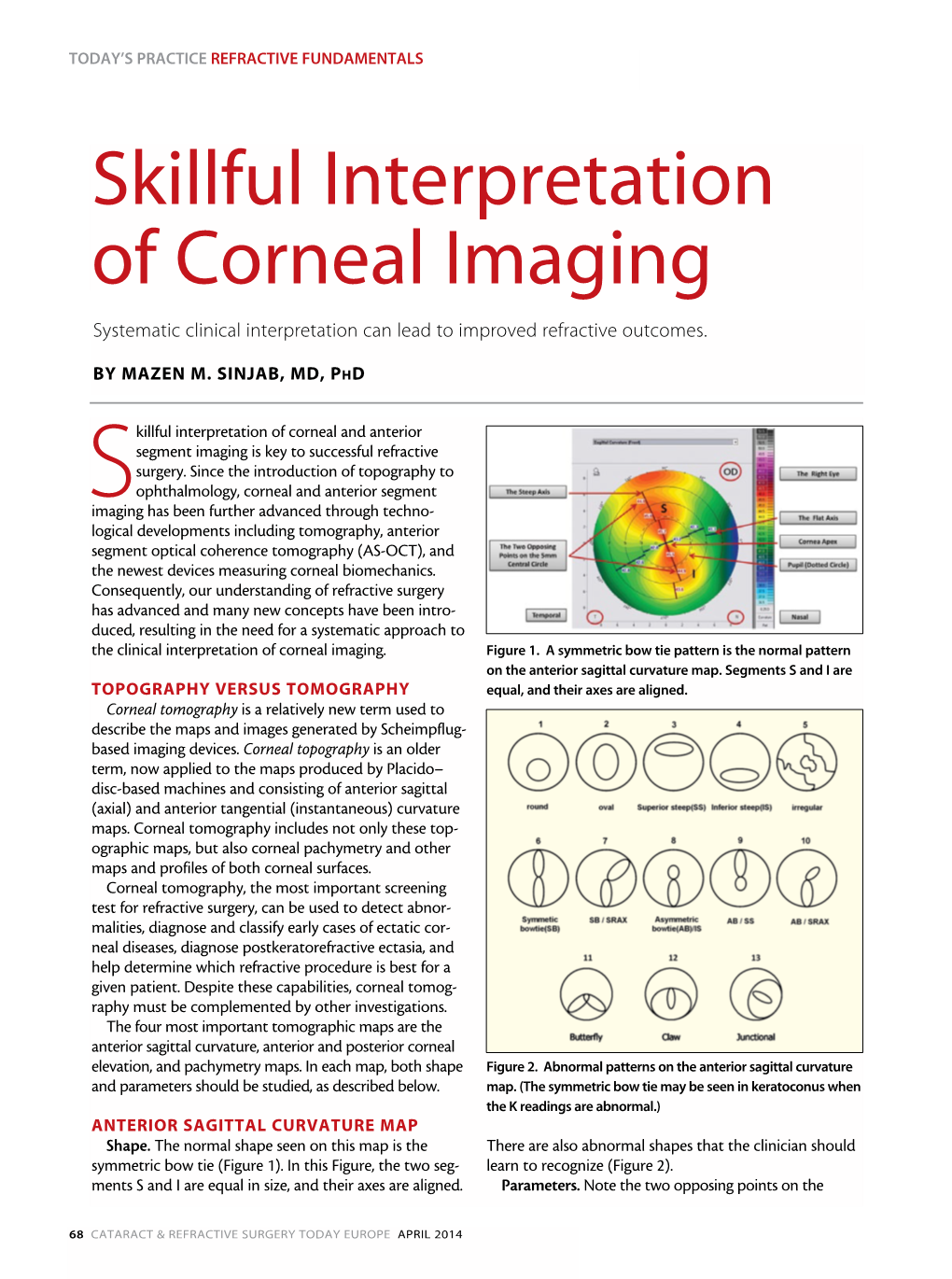 Skillful Interpretation of Corneal Imaging Systematic Clinical Interpretation Can Lead to Improved Refractive Outcomes