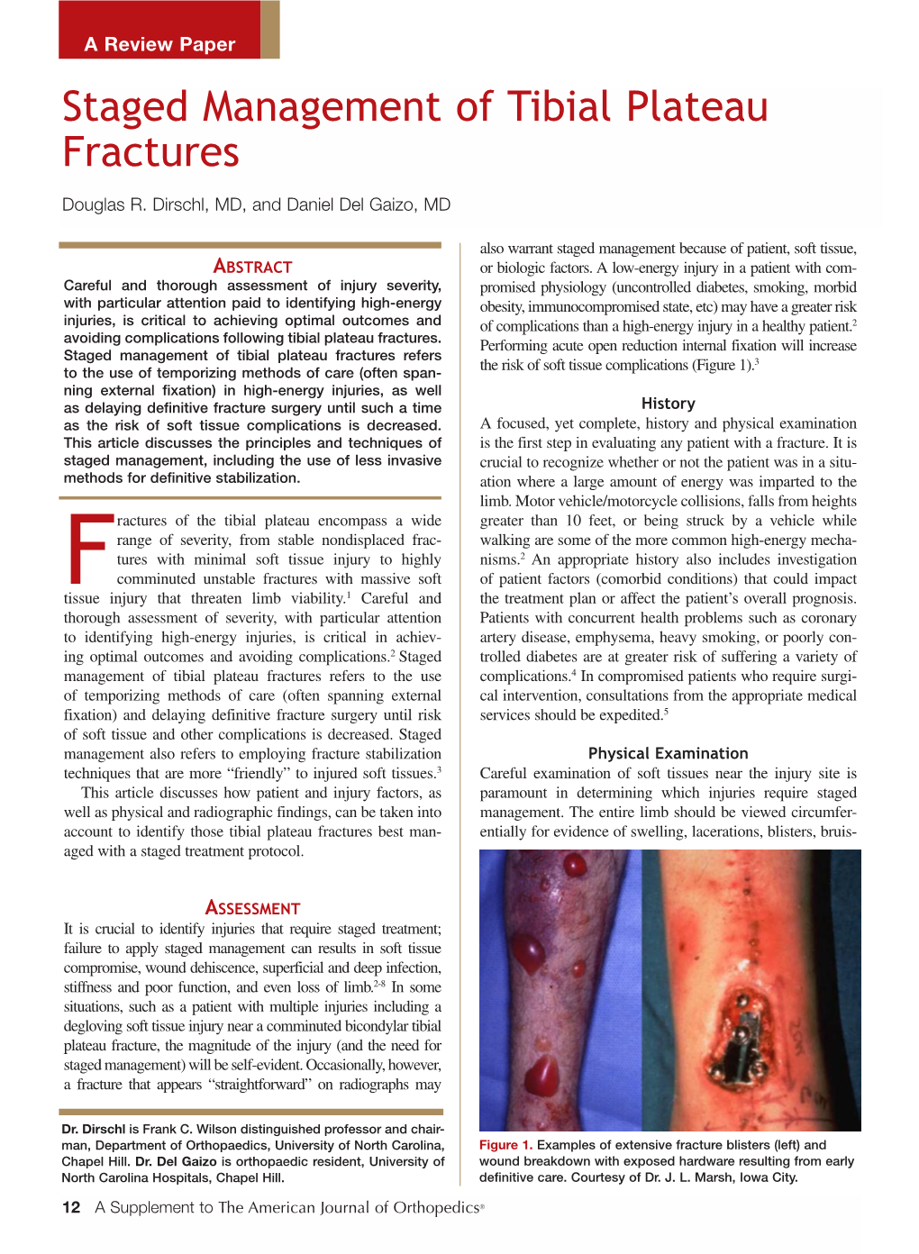 Staged Management of Tibial Plateau Fractures